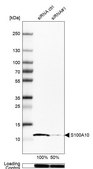 Anti-S100A10 antibody produced in rabbit Prestige Antibodies® Powered by Atlas Antibodies, affinity isolated antibody, buffered aqueous glycerol solution