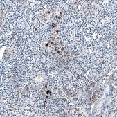 Anti-CXCL8 antibody produced in rabbit Prestige Antibodies® Powered by Atlas Antibodies, affinity isolated antibody, buffered aqueous glycerol solution