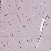 Anti-SIRT6 antibody produced in rabbit Prestige Antibodies® Powered by Atlas Antibodies, affinity isolated antibody, buffered aqueous glycerol solution