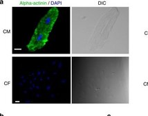 单克隆抗 α-辅肌动蛋白 小鼠抗 clone BM-75.2, ascites fluid