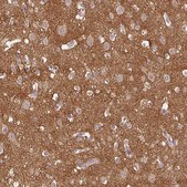 Anti-PRKAA2 antibody produced in rabbit Prestige Antibodies® Powered by Atlas Antibodies, affinity isolated antibody, buffered aqueous glycerol solution