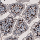 Monoclonal Anti-CD8A antibody produced in mouse Prestige Antibodies® Powered by Atlas Antibodies, clone CL1529, purified immunoglobulin, buffered aqueous glycerol solution