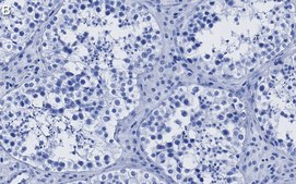 Anti-BRCA1 Antibody, clone 2C15 ZooMAb® Rabbit Monoclonal recombinant, expressed in HEK 293 cells