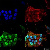 Monoclonal Anti-Ankyrin R antibody produced in mouse clone S388A-10