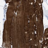 Anti-DES antibody produced in rabbit Prestige Antibodies® Powered by Atlas Antibodies, affinity isolated antibody, buffered aqueous glycerol solution