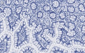 Anti-NFkB2 (p100/p52) Antibody, clone 5F3 ZooMAb® Rabbit Monoclonal recombinant, expressed in HEK 293 cells