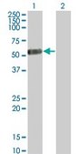 Monoclonal Anti-IL13RA2 antibody produced in mouse clone 2E10, purified immunoglobulin, buffered aqueous solution