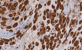 Anti-Transglutaminase 2 Antibody, clone 1G20 ZooMAb® Rabbit recombinant, expressed in HEK 293 cells