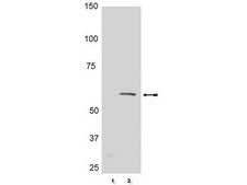抗磷酸化-Akt（Thr308）抗体，克隆50-1C-25，兔单克隆 clone NL50, Upstate®, from rabbit