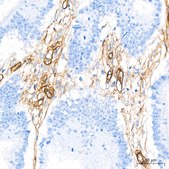 Anti-Integrin alpha 5 (ITGA5/CD49e) Antibody, clone 8F2O6, Rabbit Monoclonal