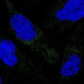 Anti-MRPS34 antibody produced in rabbit Prestige Antibodies® Powered by Atlas Antibodies, affinity isolated antibody, buffered aqueous glycerol solution