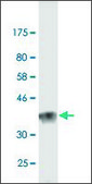 Monoclonal Anti-LAMA2, (C-terminal) antibody produced in mouse clone 1A7, purified immunoglobulin, buffered aqueous solution