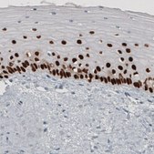 Monoclonal Anti-TP63 antibody produced in mouse Prestige Antibodies® Powered by Atlas Antibodies, clone CL3748, purified immunoglobulin, buffered aqueous glycerol solution