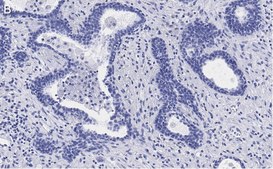 Anti-RAR-alpha Antibody, clone 3L14, ZooMAb® Rabbit Monoclonal recombinant, expressed in HEK 293 cells