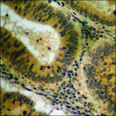 Anti-phospho-Tryptophan Hydroxylase (pSer58) antibody produced in rabbit affinity isolated antibody