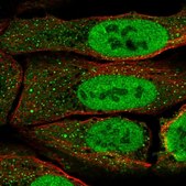 Anti-PAX5 antibody produced in rabbit Prestige Antibodies® Powered by Atlas Antibodies, affinity isolated antibody
