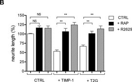 Monoclonal Anti-β-Tubulin III antibody produced in mouse clone SDL.3D10, ascites fluid