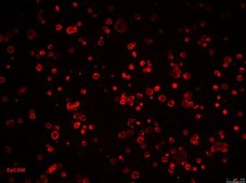 CR4 Human Colorectal Cancer Cell Line CR4 is a unique, cancer stem cell (CSC) enriched, human colorectal cancer cell line useful for CSC-targeted drug development and research focused on cancer cell and CSC biology.