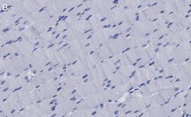 Anti-Dystrophin Antibody, clone 1G7, ZooMAb® Rabbit Monoclonal recombinant, expressed in HEK 293 cells