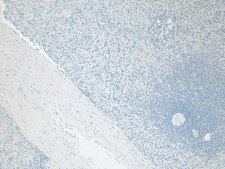 Anti-FTL antibody produced in goat affinity isolated antibody, buffered aqueous solution