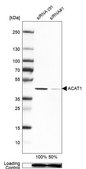 Anti-ACAT1 antibody produced in rabbit Ab1, Prestige Antibodies® Powered by Atlas Antibodies, affinity isolated antibody, buffered aqueous glycerol solution