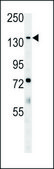ANTI-ATP11C (CENTER) antibody produced in rabbit IgG fraction of antiserum, buffered aqueous solution