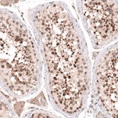 Anti-NUP54 antibody produced in rabbit Prestige Antibodies® Powered by Atlas Antibodies, affinity isolated antibody, buffered aqueous glycerol solution
