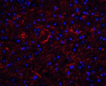 Anti-Clusterin antibody produced in rabbit affinity isolated antibody, buffered aqueous solution