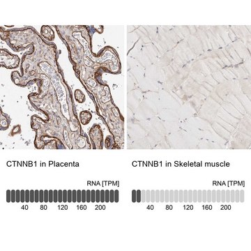Anti-CTNNB1 antibody produced in rabbit Prestige Antibodies® Powered by Atlas Antibodies, affinity isolated antibody, buffered aqueous glycerol solution, ab2