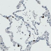 Monoclonal Anti-MMP9 antibody produced in mouse Prestige Antibodies® Powered by Atlas Antibodies, clone CL0538, purified immunoglobulin, buffered aqueous glycerol solution