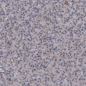 Anti-ALDH5A1 antibody produced in rabbit Prestige Antibodies® Powered by Atlas Antibodies, affinity isolated antibody, buffered aqueous glycerol solution, ab2
