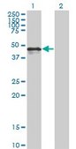 Monoclonal Anti-CALR antibody produced in mouse clone 1G11-1A9, purified immunoglobulin, buffered aqueous solution