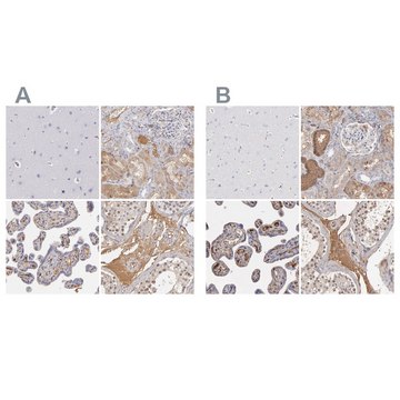 Anti-SERPINA1 antibody produced in rabbit Prestige Antibodies® Powered by Atlas Antibodies, affinity isolated antibody, buffered aqueous glycerol solution