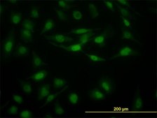 ANTI-STAT5B antibody produced in mouse clone 2D1, purified immunoglobulin, buffered aqueous solution