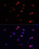 Anti-IL6 antibody produced in rabbit