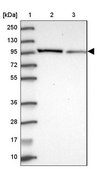 Anti-NPEPPS antibody produced in rabbit Prestige Antibodies® Powered by Atlas Antibodies, affinity isolated antibody, buffered aqueous glycerol solution