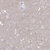 Anti-GABBR2 antibody produced in rabbit Prestige Antibodies® Powered by Atlas Antibodies, affinity isolated antibody, buffered aqueous glycerol solution