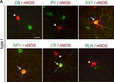 Anti-Parvalbumin Antibody ascites fluid, clone PARV-19, Chemicon®
