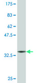 Monoclonal Anti-WT1 antibody produced in mouse clone 1E9, purified immunoglobulin, buffered aqueous solution