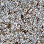 Anti-NGFR antibody produced in rabbit Prestige Antibodies® Powered by Atlas Antibodies, affinity isolated antibody, buffered aqueous glycerol solution