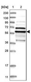 Anti-TUBE1 antibody produced in rabbit Prestige Antibodies® Powered by Atlas Antibodies, affinity isolated antibody, buffered aqueous glycerol solution, ab2