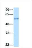 Anti-HDAC1 antibody produced in rabbit affinity isolated antibody