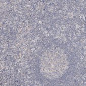 Anti-DMD antibody produced in rabbit Prestige Antibodies® Powered by Atlas Antibodies, affinity isolated antibody, buffered aqueous glycerol solution