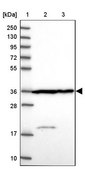Anti-CNN2 antibody produced in rabbit Prestige Antibodies® Powered by Atlas Antibodies, affinity isolated antibody, buffered aqueous glycerol solution