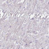Anti-MYLK2 antibody produced in rabbit Prestige Antibodies® Powered by Atlas Antibodies, affinity isolated antibody, buffered aqueous glycerol solution