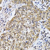 Anti-p53 antibody produced in rabbit