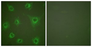 Anti-Collagen II antibody produced in rabbit affinity isolated antibody