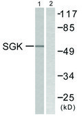 Anti-SGK antibody produced in rabbit affinity isolated antibody