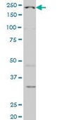 Monoclonal Anti-WRN antibody produced in mouse clone 3C11, purified immunoglobulin, buffered aqueous solution