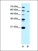 Anti-PKLR antibody produced in rabbit IgG fraction of antiserum
